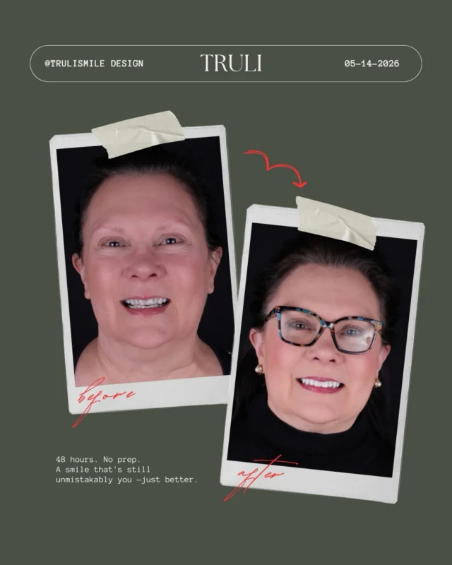 She asked. We listened. We delivered. 

This is what happens when you finally say yes to yourself. ✨ 

JOIN THE WAITLIST • LINK IN BIO

#trulismile #sacramentodentist #smiledesign #cosmeticdentistry #cosmeticdentist